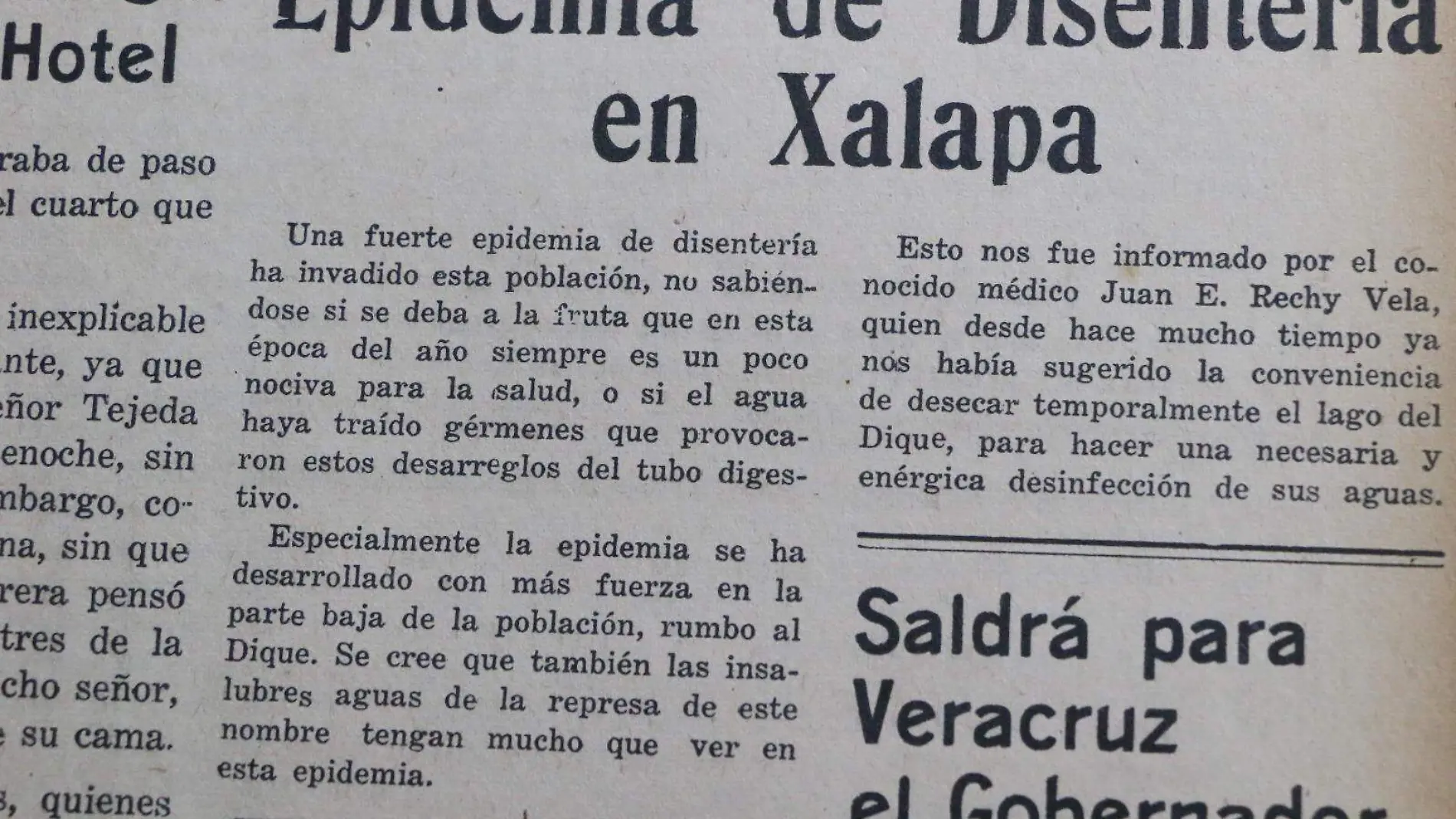 En 1945 Xalapa registró una epidemia por la enfermedad